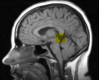 Операция по удалению кисты головного мозга: стоимость и последствия при эндоскопическом