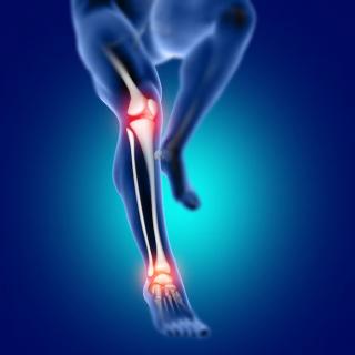 Гемартроз коленного сустава